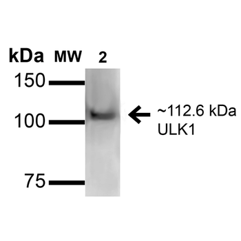 ULK1 Antibody (HRP)