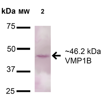 VMP1 Antibody (FITC)