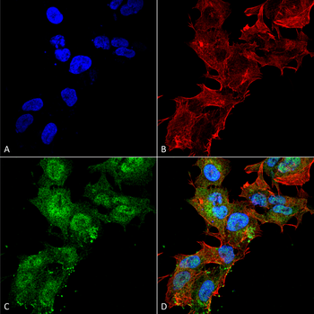 Calcium Sensing Receptor Antibody (APC)