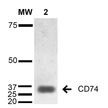 CD74 Antibody (HRP)