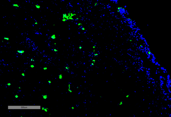 Acrolein Antibody