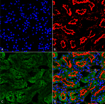 Sulfotyrosine Antibody (HRP)