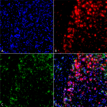 Alpha Synuclein Antibody (FITC)