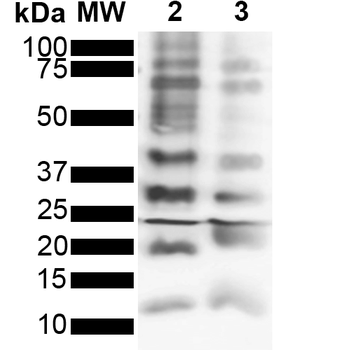 Ubiquitin Antibody (RPE)