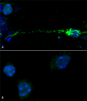 Alpha Synuclein (pSer129) Antibody