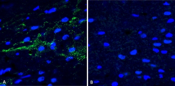 Alpha Synuclein (pSer129) Antibody (FITC)