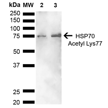 HSP70 (Acetyl Lys77) Antibody (Biotin)