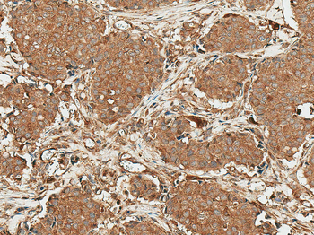 ROR1 Antibody (Biotin)