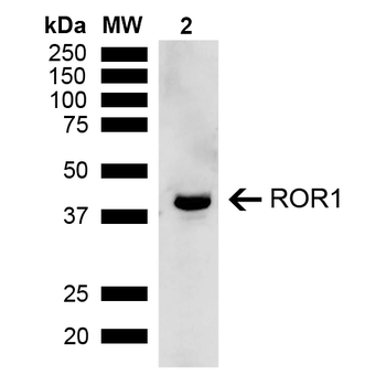ROR1 Antibody (Biotin)
