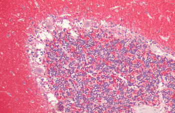 Alpha Synuclein Antibody (APC)