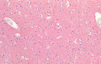 Tau Antibody (PerCP)