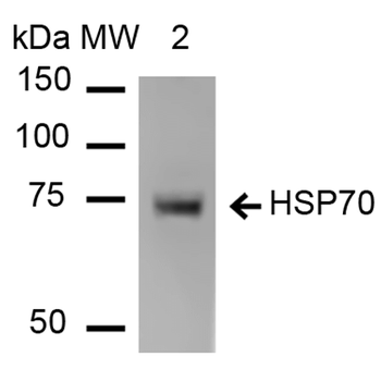 HSP70 Antibody (FITC)