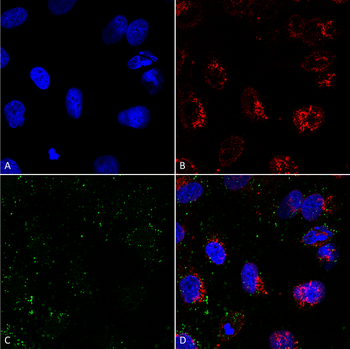 HSP70 Antibody (FITC)
