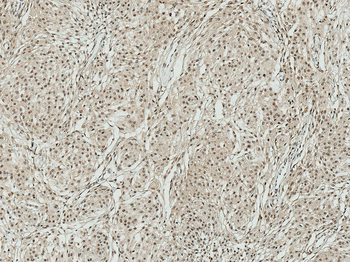 ATG7 Antibody (HRP)