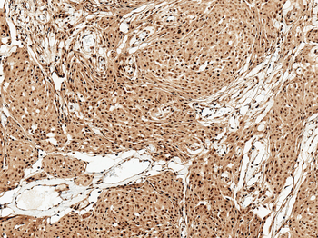 FUNDC1 Antibody (FITC)