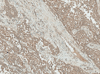 IGF-1 Antibody (Biotin)