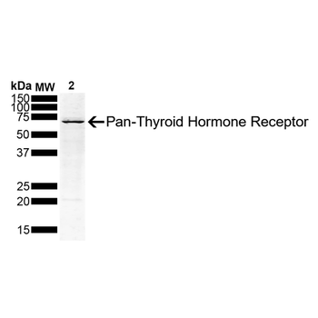 Thyroid Hormone Receptor Antibody (APC)