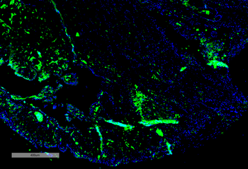 parvalbumin Antibody