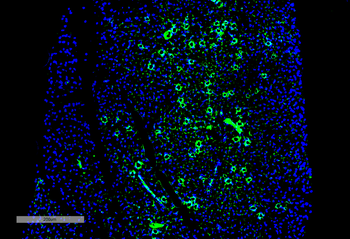 parvalbumin Antibody