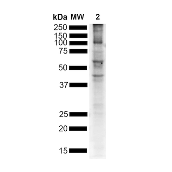 Alpha Synuclein (pSer129) Antibody
