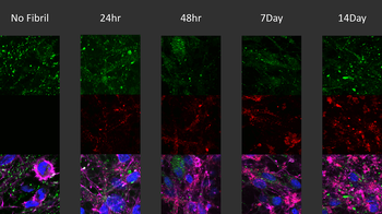 Alpha Synuclein (pSer129) Antibody (Biotin)