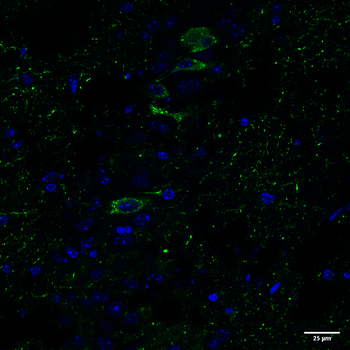 Tau (pSer202/ pThr205) Antibody (FITC)