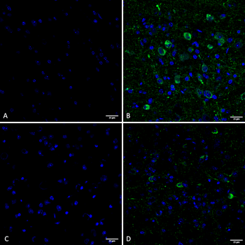 Tau (pSer202/ pThr205) Antibody (RPE)