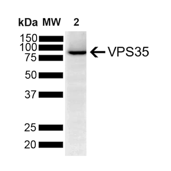VPS35 Antibody (RPE)