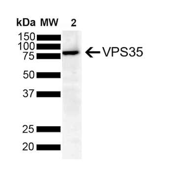 VPS35 Antibody (Biotin)