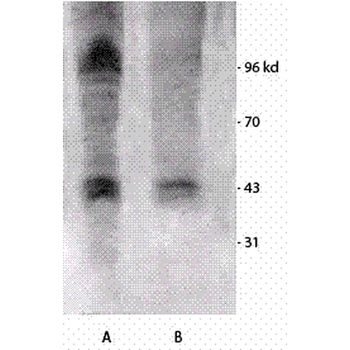 Phosphothreonine Antibody