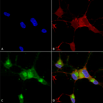 Nav1.7 Antibody