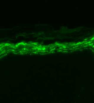 Nav1.7 Antibody