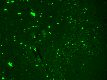 Nav1.7 Antibody