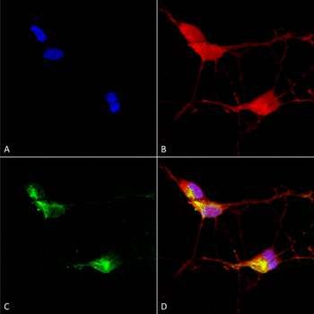 TRPV3 Antibody