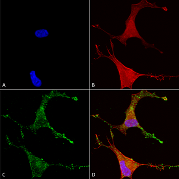 CavBeta2 Antibody