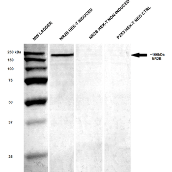 NR2B Antibody