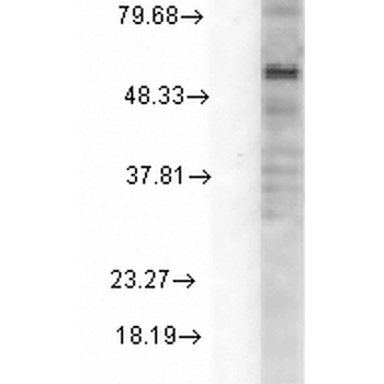 GABA A Receptor Antibody