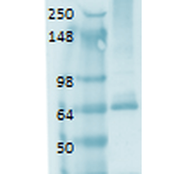 Sodium Iodide Symporter Antibody