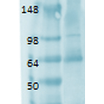 Sodium Iodide Symporter Antibody