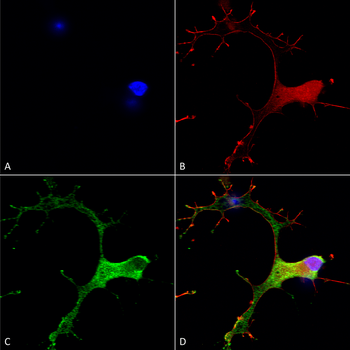 GABA B Receptor 1 Antibody