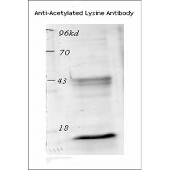 Acetylated Lysine Antibody (Biotin)
