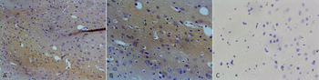 NOS1 Antibody (HRP)