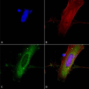 NR2A Antibody