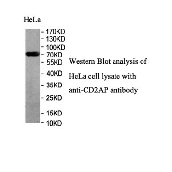 CD2AP Rabbit Polyclonal Antibody