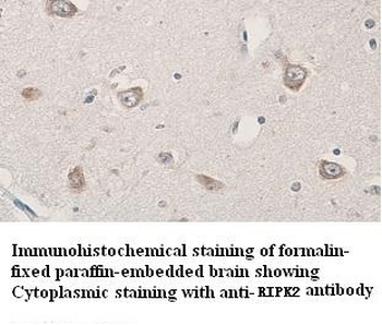 RIPK2 Rabbit Polyclonal Antibody
