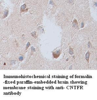 CNTFR Rabbit Polyclonal Antibody