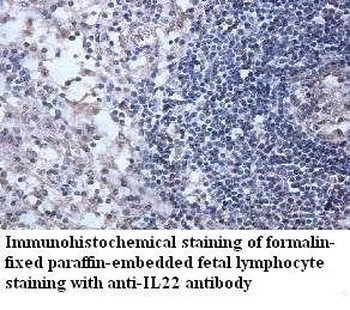 IL22 Rabbit Polyclonal Antibody