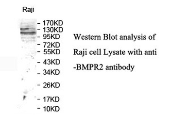 BMPR2 Rabbit Polyclonal Antibody