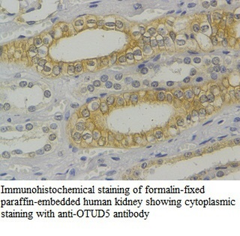 OTUD5 Rabbit Polyclonal Antibody