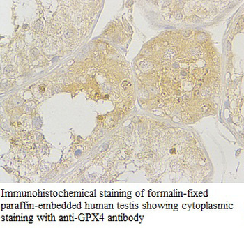 GPX4 Rabbit Polyclonal Antibody